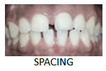 Spacing